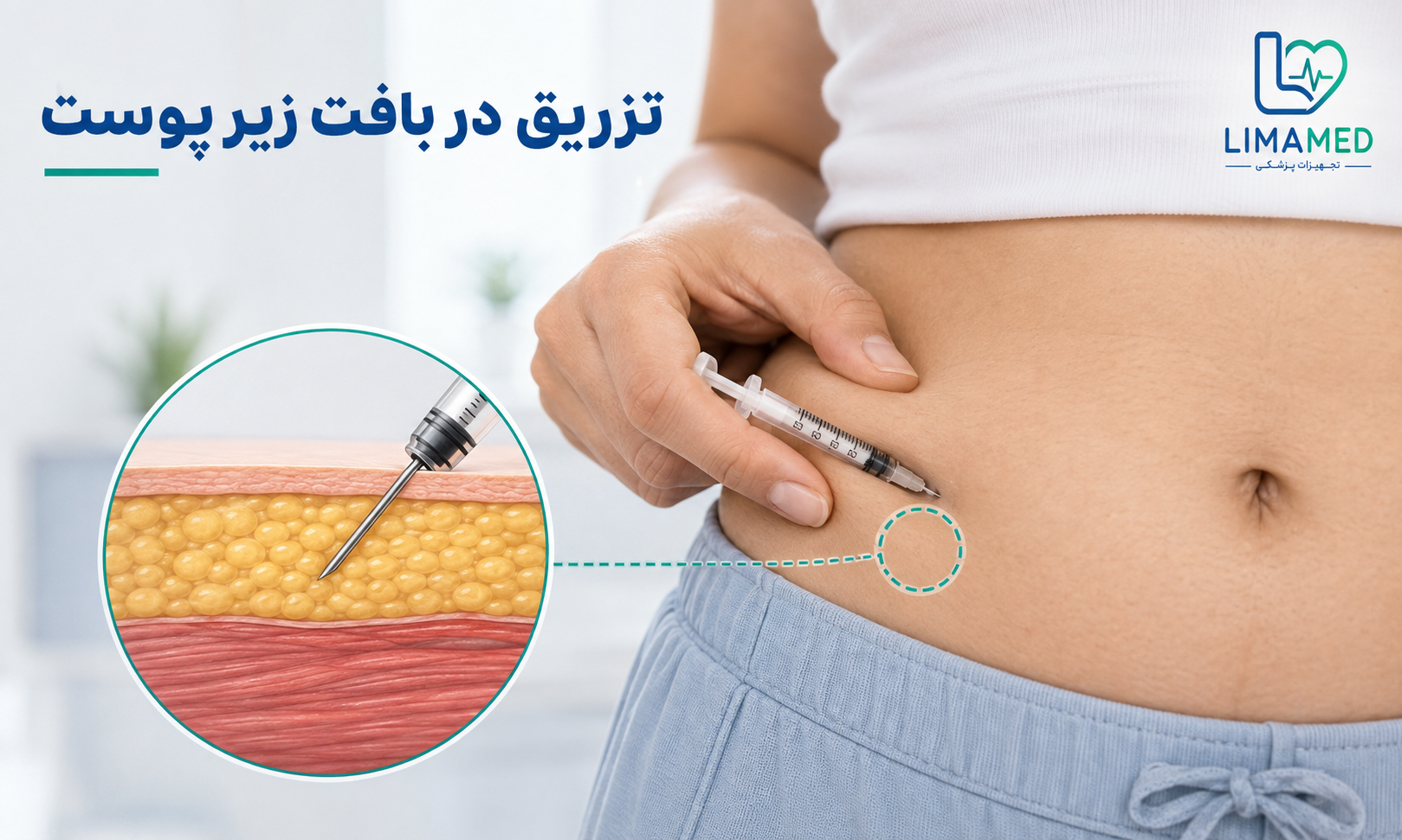 زاویه صحیح تزریق زیرجلدی انسولین با سرنگ